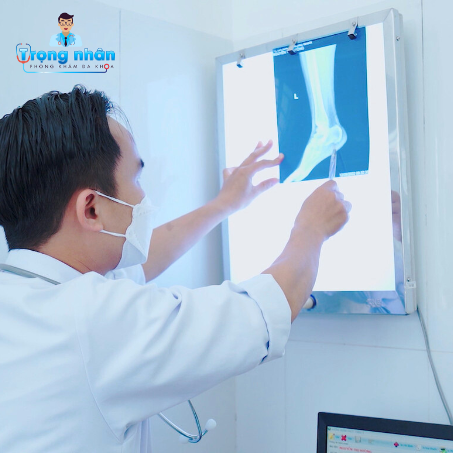 Khoa Cơ Xương Khớp