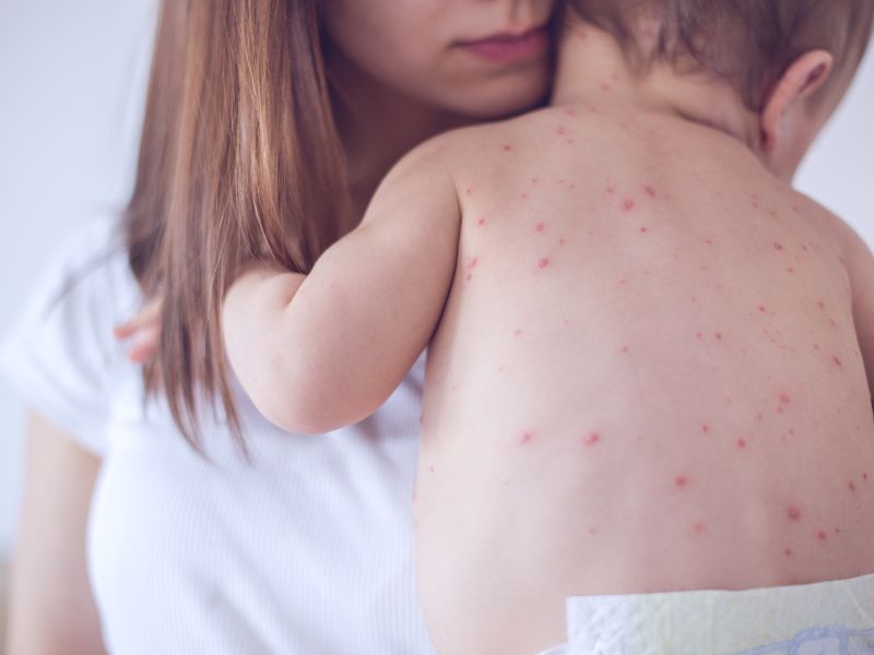 5 Bệnh Lý Thường Gặp Ở Trẻ Nhỏ Mùa Giao Mùa