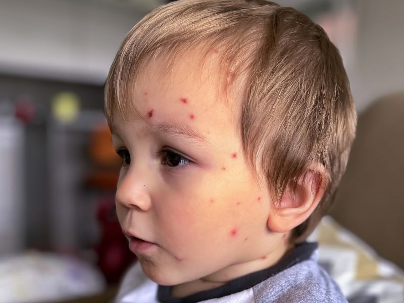 5 Bệnh Lý Thường Gặp Ở Trẻ Nhỏ Mùa Giao Mùa