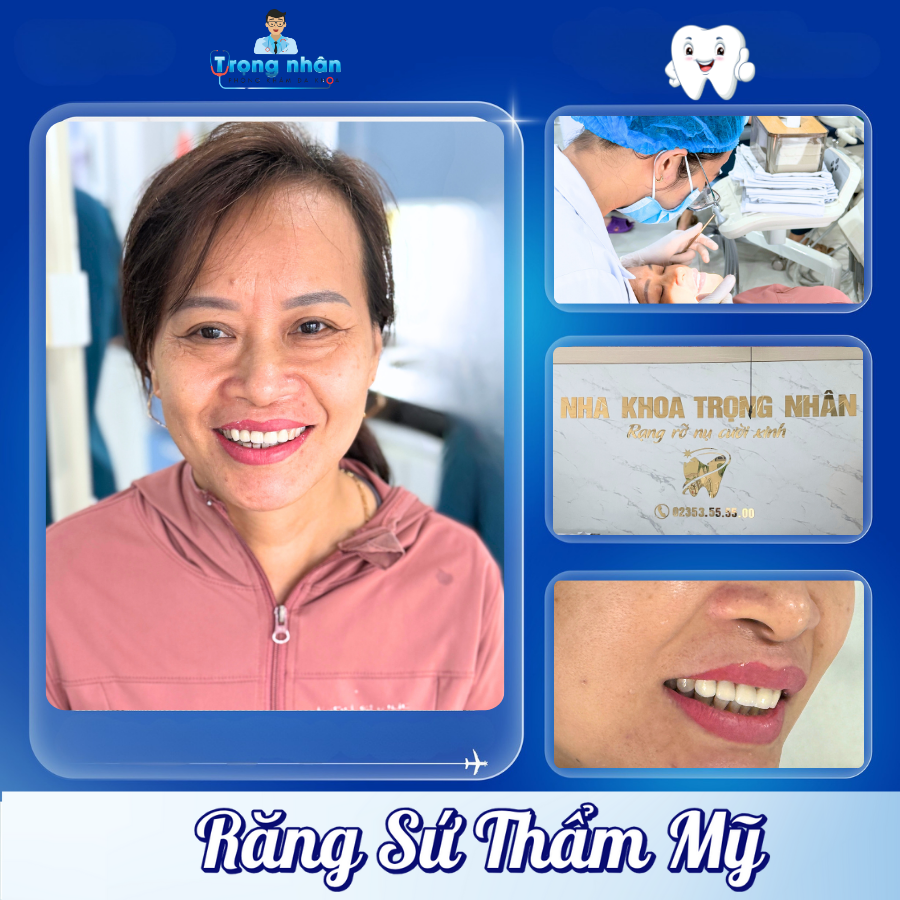 răng sứ thẩm mỹ