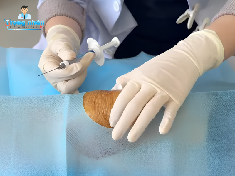 Tiêm chất nhờn khớp gối