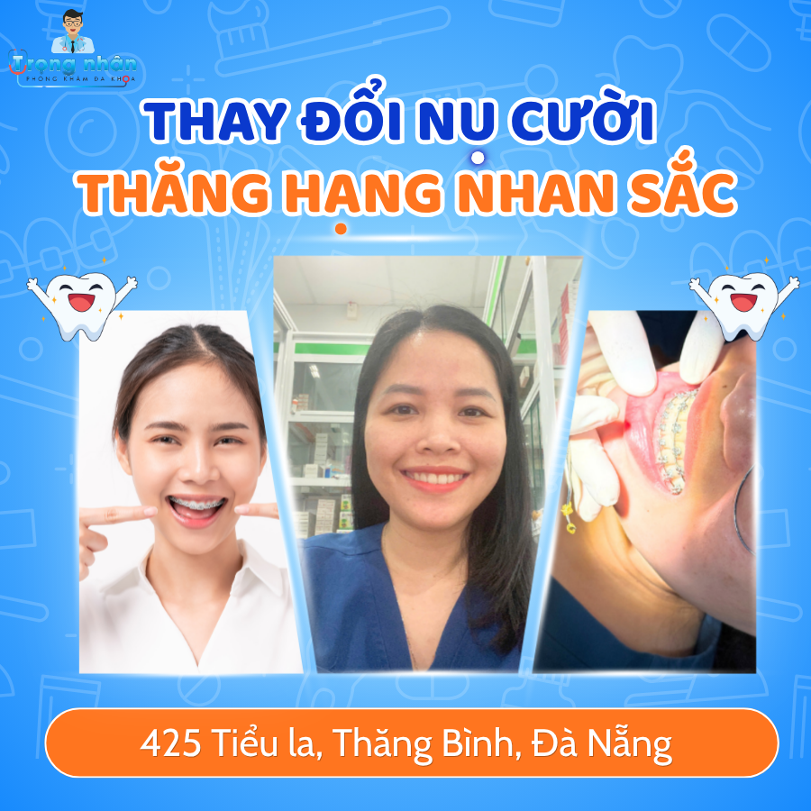 Thay đổi nụ cười